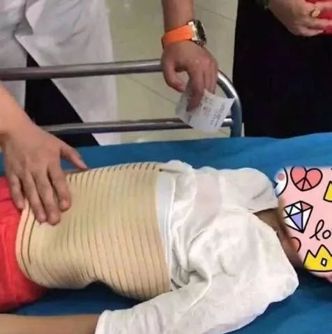 男童爬健身器材被女孩推倒骨折