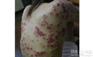 单亲爸爸的女儿患上红斑狼疮，一夜之间白发如丝——母爱的力量
