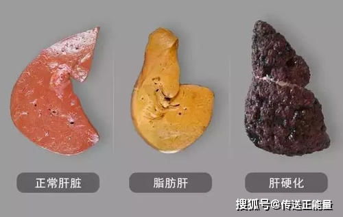 汽车冷却液的正确量，了解为何过多或过少都不好