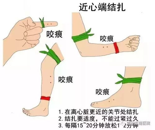 如何快速辨别是否被毒蛇咬伤，识别症状与应对措施